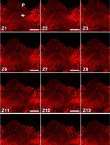 Modified Pseudo-Schiff Propidium Iodide for Staining the Shoot Apical Meristem in <em>Arabidopsis</em>