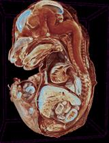 E15.5 Mouse Embryo Micro-CT Using a Bruker Skyscan 1172 Micro-CT