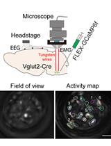 Simultaneous Microendoscopic Calcium Imaging and EEG Recording of Mouse Brain during Sleep