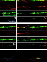 Long-term in toto Imaging of Cellular Behavior during Nerve Injury and Regeneration