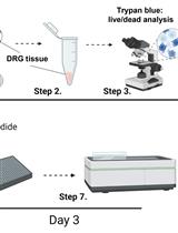 Implementation of a Drug Screening Platform to Target Gch1 Expression in Injured Mouse Dorsal Root Ganglion Neurons
