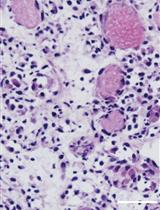 Induction of Skeletal Muscle Injury by Intramuscular Injection of Cardiotoxin in Mouse