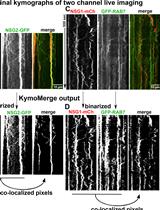 Quantifying Single and Dual Channel Live Imaging Data: Kymograph Analysis of Organelle Motility in Neurons