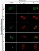 THRIFTY—A High-throughput Single Muscle Fiber Typing Method Based on Immunofluorescence Detection