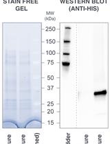 Expression and Purification of scFv<sub>2H7</sub>-P18F3, a Bi-Modular Fusion Protein (BMFP) Targeting Human CD20