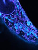 Ten-fold Robust Expansion Microscopy