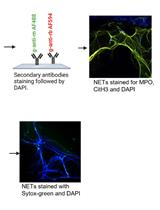 A New Methodology for the Quantification of Neutrophil Extracellular Traps in Patient Plasma