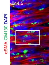 Systematic Analysis of Smooth Muscle and Cartilage Ring Formation during Mouse Tracheal Tubulogenesis