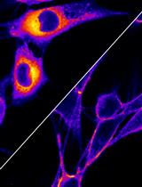 Visualizing NBD-lipid Uptake in Mammalian Cells by Confocal Microscopy