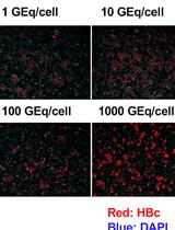 Production and Purification of Cell Culture–generated Hepatitis B Virus by Transient Transfection and Density Gradient