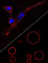 Visualizing Loss of Plasma Membrane Lipid Asymmetry Using Annexin V Staining