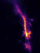 Recoil Measurements in Drosophila Embryos: from Mounting to Image Analysis
