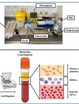 利用 3D OrbiSIMS 对体外极化免疫细胞和宿主对体内植入生物结构聚合物的反应进行无标记化学表征