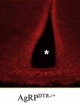 Construction of Activity-based Anorexia Mouse Models