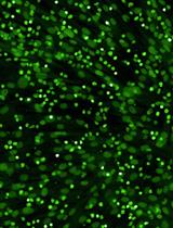 Ex vivo Drug Sensitivity Imaging-based Platform for Primary Acute Lymphoblastic Leukemia Cells