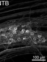Stereotactic Delivery of Helper-dependent Adenoviral Viral Vectors at Distinct Developmental Time Points to Perform Age-dependent Molecular Manipulations of the Mouse Calyx of Held
