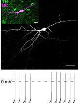 Perforated Patch Clamp Recordings in ex vivo Brain Slices from Adult Mice