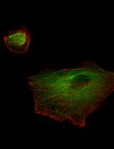 Preparation of Human Kidney Progenitor Cultures and Their Differentiation into Podocytes