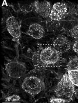 Confocal Imaging and 3D Reconstruction to Determine How Genetic Perturbations Impact Presynaptic Morphology at the Mouse Calyx of Held