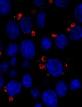 Double Staining with Fluorescent Tracers to Determine Myeloid Cell Migration of <em>Leishmania</em>-infected Cells from Mouse Skin to Lymphatic Tissues by Flow Cytometry