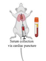 Computational Analysis of Plasma Lipidomics from Mice Fed Standard Chow and Ketogenic Diet