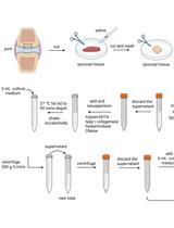 Successful Transfection of MicroRNA Mimics or Inhibitors in a Regular Cell Line and in Primary Cells Derived from Patients with Rheumatoid Arthritis