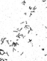 Isolation of Epithelial and Stromal Cells from Colon Tissues in Homeostasis and Under Inflammatory Conditions