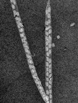 A Novel Imaging Protocol for Investigating Arabidopsis thaliana Siliques and Seeds Using X-rays