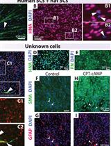 Human Schwann Cells in vitro III. Analytical Methods and a Practical Approach for Quality Control