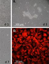 Mouse Corneal Epithelial and Stromal Cell Isolation and Culture