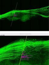 Application of Electrical Stimulation to Enhance Axon Regeneration Following Peripheral Nerve Injury