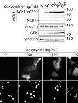 Doxycycline-inducible Expression of Proteins at Near-endogenous Levels in Mammalian Cells Using the Sleeping Beauty Transposon System