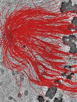 Serial-section Electron Tomography and Quantitative Analysis of Microtubule Organization in 3D-reconstructed Mitotic Spindles