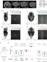 Princeton RAtlas: A Common Coordinate Framework for Fully cleared, Whole <em>Rattus norvegicus</em> Brains