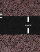 Studying Cell Migration (Random and Wound Healing) Parameters with Imaging and MATLAB Analysis