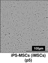 人类诱导多能干细胞 (iPSC) 来源的间充质祖细胞分化为软骨细胞
