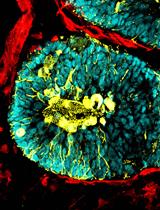 Generation of Human Blood Vessel and Vascularized Cerebral Organoids