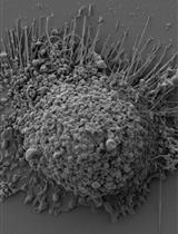 Reprogramming Cancer Cells to Antigen-presenting Cells