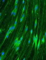Human Schwann Cells in vitro II. Passaging, Purification, Banking, and Labeling of Established Cultures