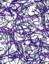 从酿酒酵母中纯化人类细胞质肌动蛋白