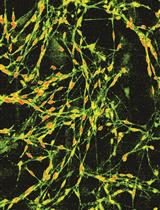 Dissociation and Culture of Adult Mouse Satellite Glial Cells