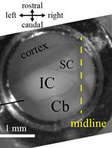Headplate Installation and Craniotomy for Awake In Vivo Electrophysiological Recordings or Two-Photon Imaging of the Mouse Inferior Colliculus
