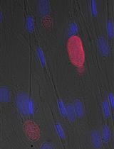 Generation of Mature Toxoplasma gondii Bradyzoites in Human Immortalized Myogenic KD3 Cells