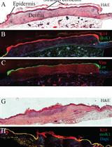 The Development of an Advanced Model for Multilayer Human Skin Reconstruction In Vivo