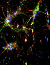 Isolation and Enrichment of Major Primary Neuroglial Cells from Neonatal Mouse Brain