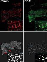 High-throughput Analysis of Capillary Density in Skeletal Muscle Cross Sections