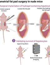 Mesenteric Parametrial Fat Pad Surgery for in vivo Implantation of Hepatocytes in Nude Mice