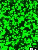 Streamlined Adeno-Associated Virus Production Using Suspension HEK293T Cells