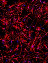 Generation of Human Induced Pluripotent Stem Cell (hiPSC)-Derived Astrocytes for Amyotrophic Lateral Sclerosis and Other Neurodegenerative Disease Studies