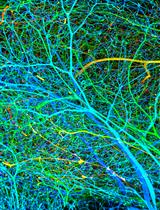 A Versatile Pipeline for High-fidelity Imaging and Analysis of Vascular Networks Across the Body